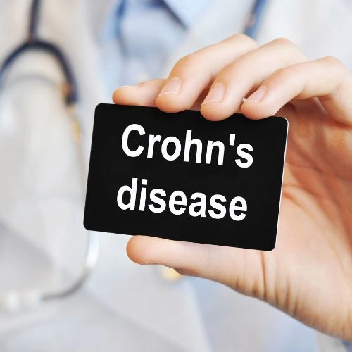 Crohn's Disease And Cannabis